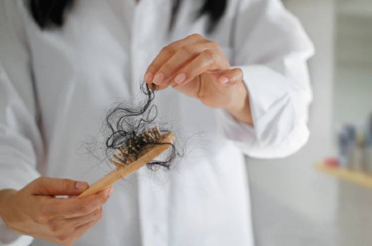 Сильный стресс может спровоцировать выпадение волос