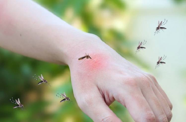 Названы способы снять зуд от комариных укусов